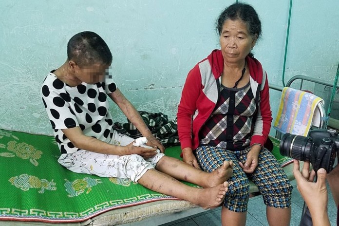 Vụ tra tấn bẻ răng, đốt da, chặt tay người làm thuê tại Gia Lai: Phải khởi tố vụ án