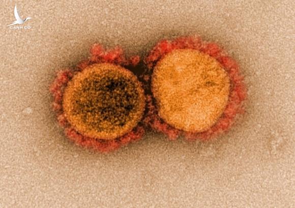 ‘Kịch bản ác mộng’ từ biến chủng virus mới phát hiện ở California