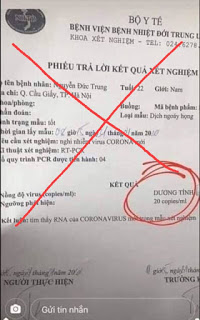 Xuất hiện phiếu xét nghiệm giả có kết quả dương tính virus Corona gây hoang mang dư luận