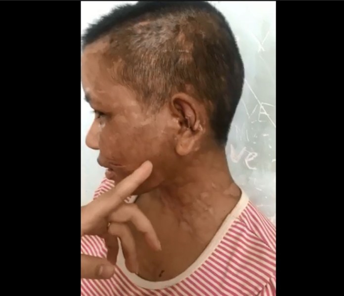 Vụ tra tấn bẻ răng, đốt da, chặt tay người làm thuê tại Gia Lai: Phải khởi tố vụ án