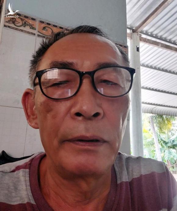 Cử tri Đồng Nai muốn làm rõ vụ ông Phạm Văn Sáng bỏ trốn